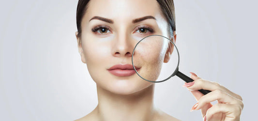 Unreine Haut: So bringst du deine Haut ins Gleichgewicht